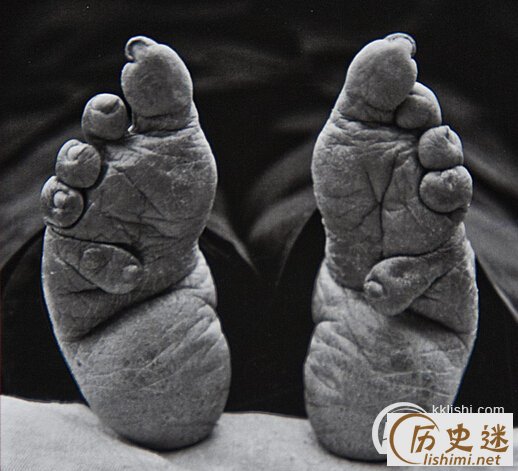 三寸金莲起源于何时?为何缠足要称为三寸金莲