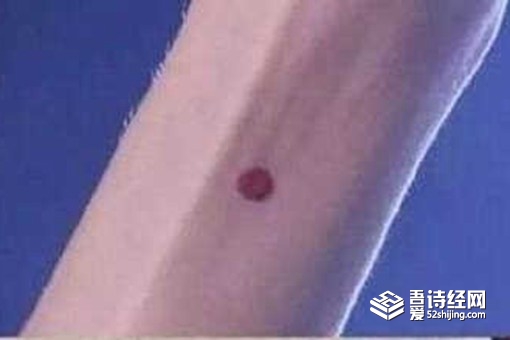 古代守宫砂是怎么制作的 原理是什么