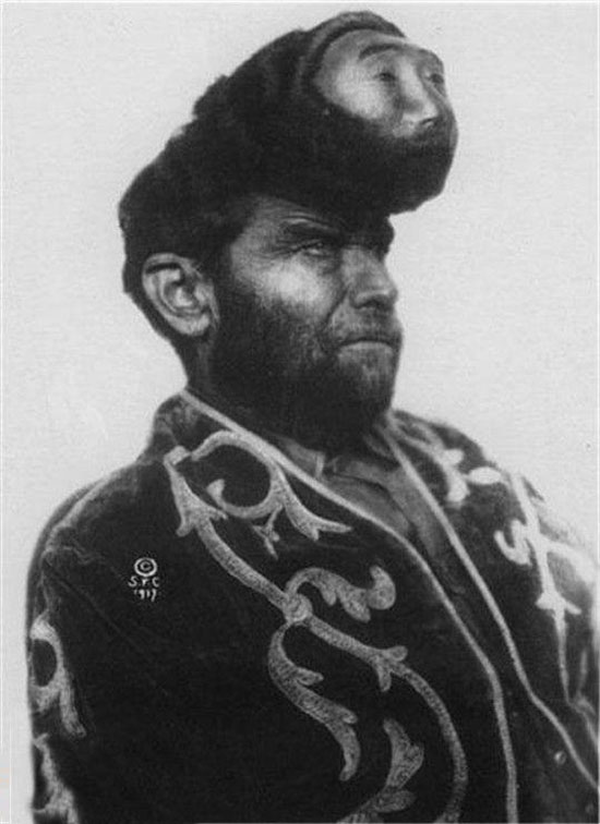 世界上仅有的双面人,世界上有双面的手机吗?